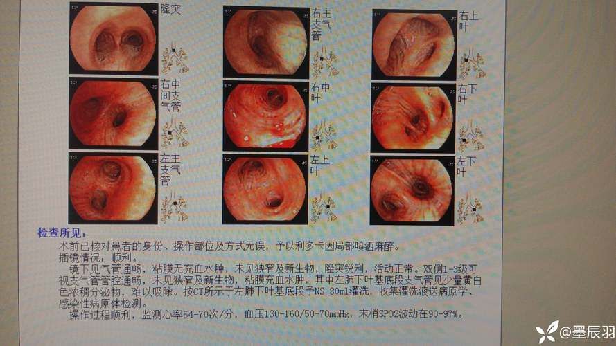 【福建省泉州市德化县新增5例阳性感染者及27例无症状_福建泉州德化新闻】