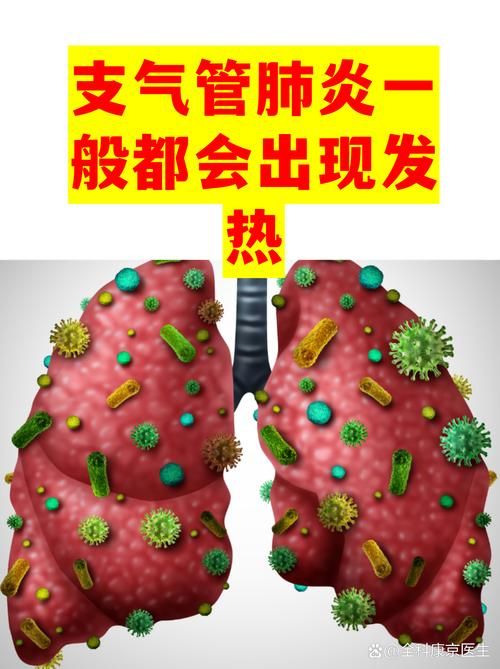专家:海安市每年或现多个感染高峰_海安市有没有新型肺炎