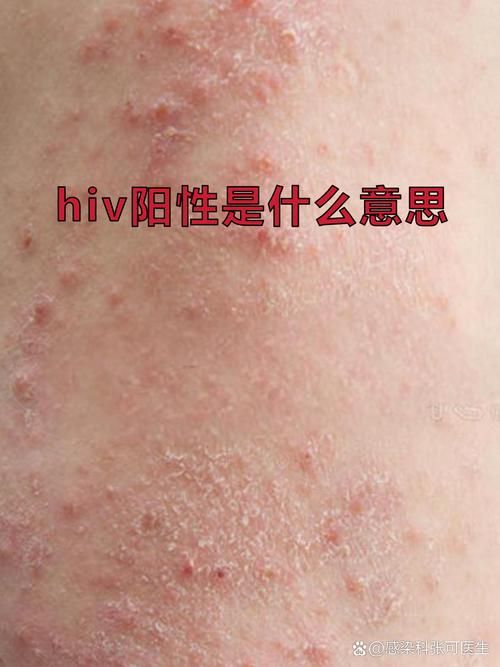 全球近期新增10例阳性感染者(全球近期新增10例阳性感染者是哪里的)