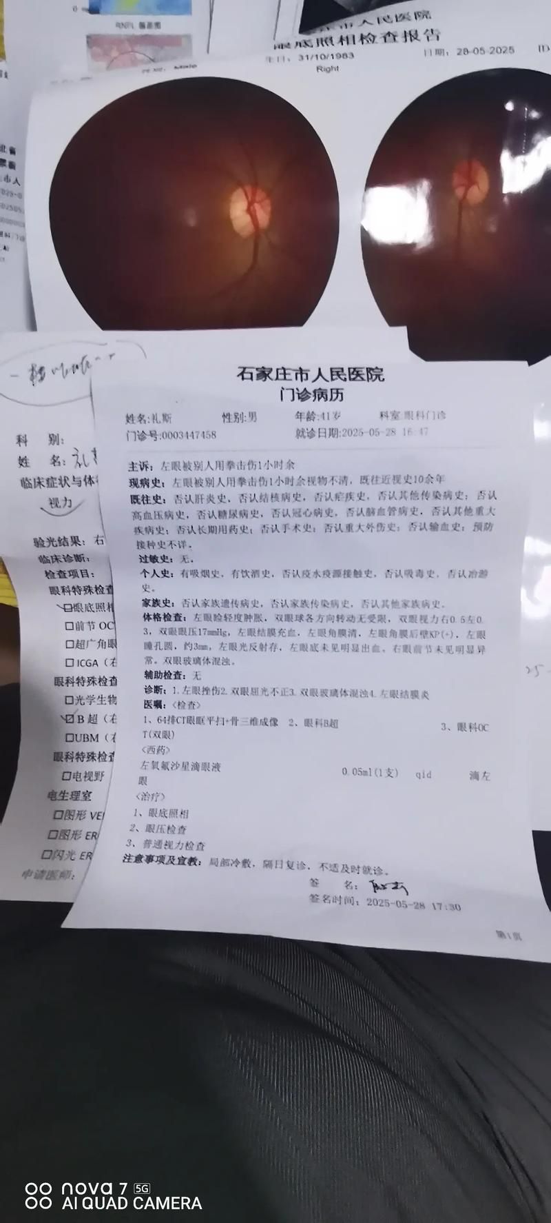 河南平顶山郏县静默区重症详情/今天平顶山郏县