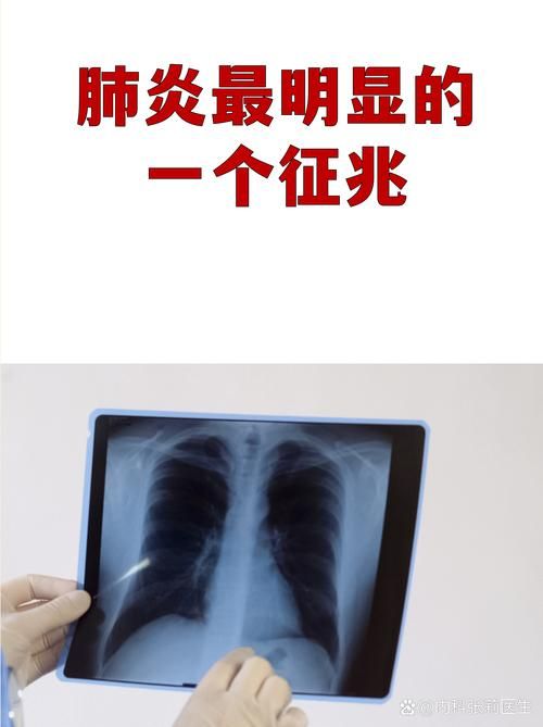 东乡族自治县今冬新增感染趋势反弹(东乡确诊新型冠状病毒)