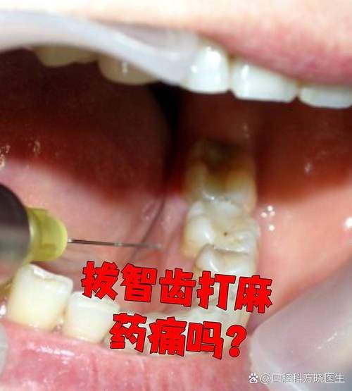查找最新疫情猇亭区/屺亭今天有打疫苗的吗