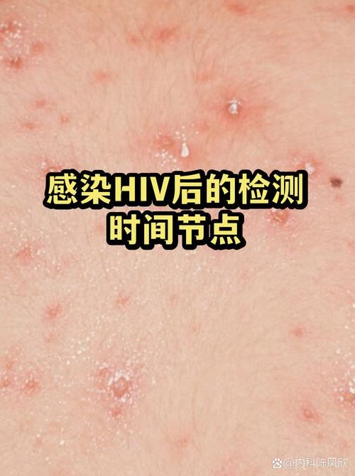 黄山市现有核酸阳性13例/黄山市有艾滋病患者吗